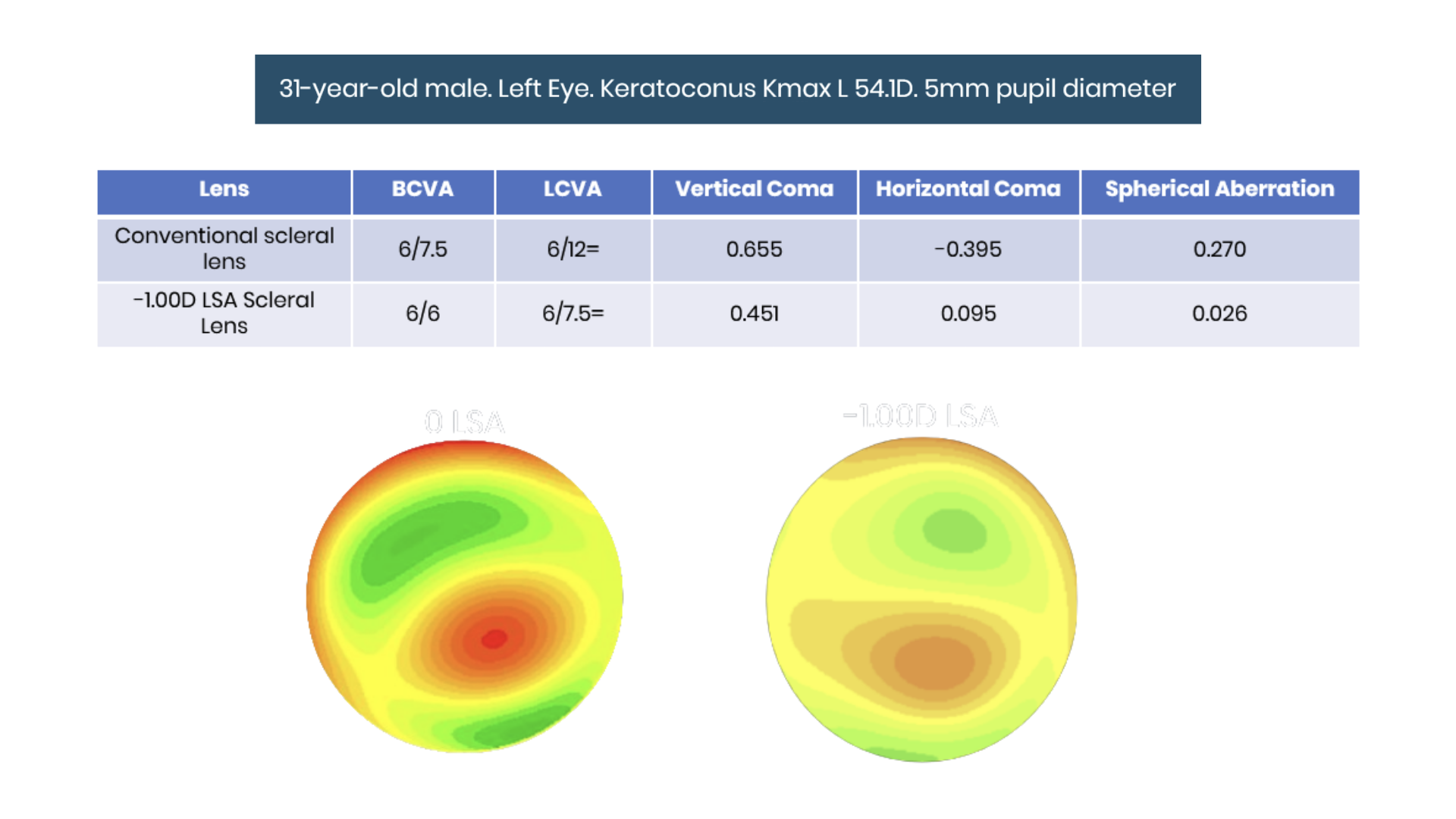 Case study infographic of an individual who received HOA correction and has significant improvement in vision
